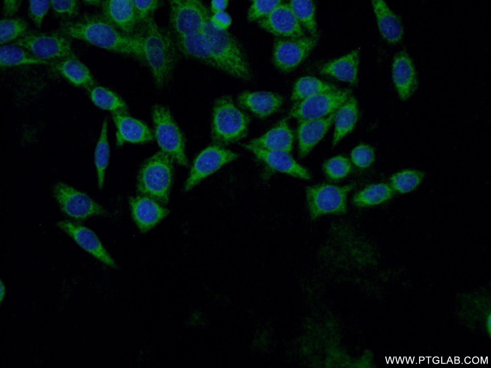 Immunofluorescence (IF) / fluorescent staining of HeLa cells using DHPS Polyclonal antibody (11184-1-AP)