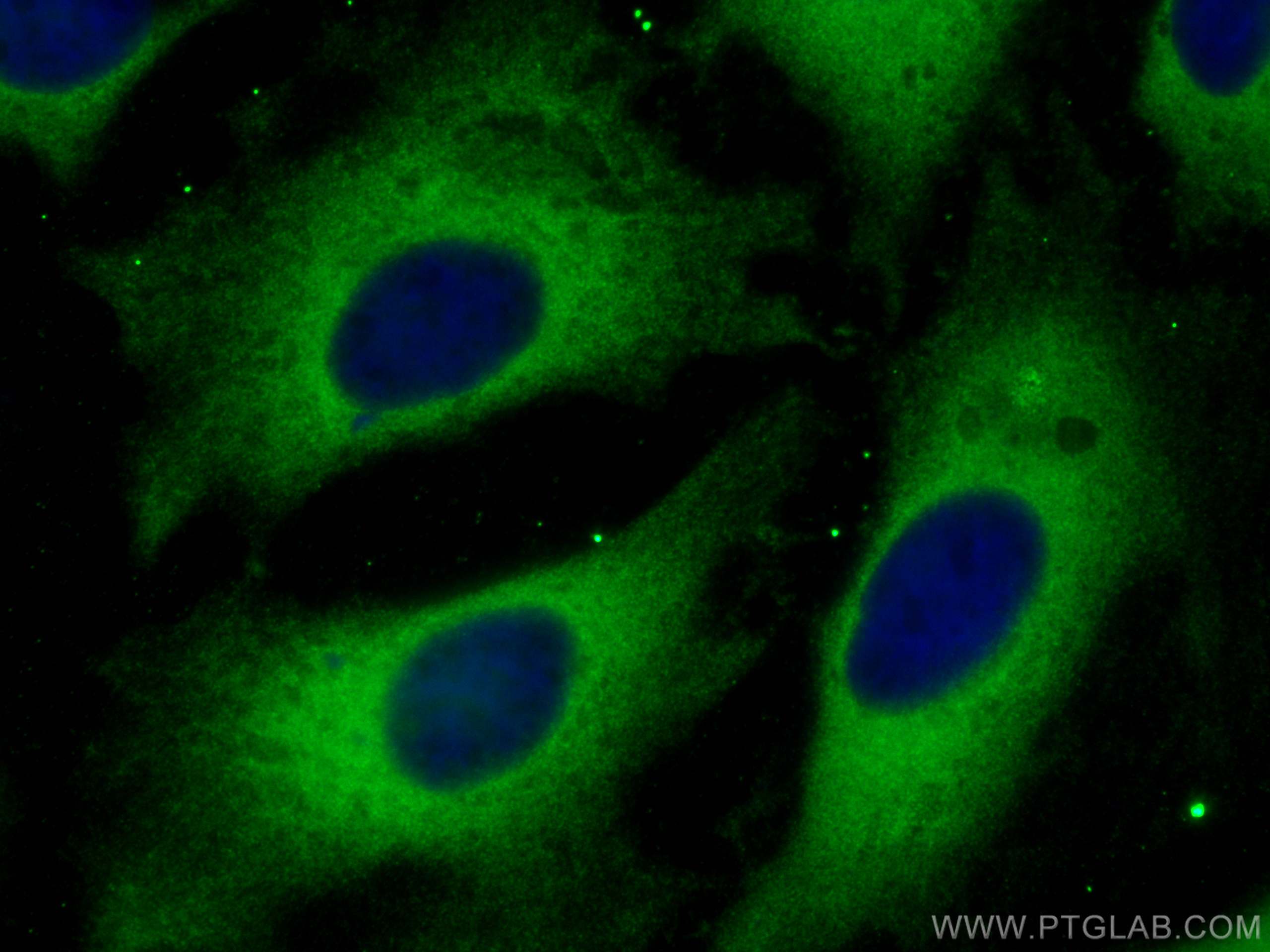 Immunofluorescence (IF) / fluorescent staining of HeLa cells using DHPS Polyclonal antibody (11184-1-AP)