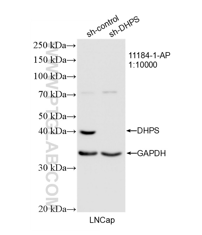 Western Blot (WB) analysis of LNCaP cells using DHPS Polyclonal antibody (11184-1-AP)