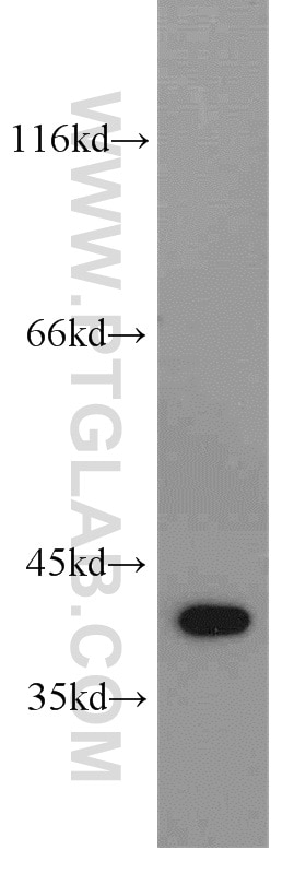 Western Blot (WB) analysis of HeLa cells using DHPS Polyclonal antibody (11184-1-AP)