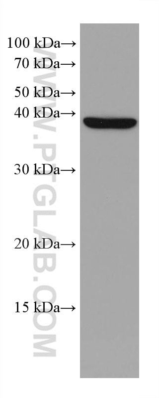 Western Blot (WB) analysis of LNCaP cells using DHPS Monoclonal antibody (67998-1-Ig)