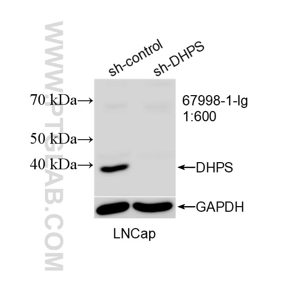 WB analysis of LNCaP using 67998-1-Ig Western Blot (WB) analysis of LNCaP cells using DHPS Monoclonal antibody (67998-1-Ig)