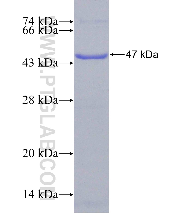 DHPS fusion protein Ag31046 SDS-PAGE