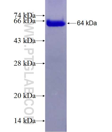 DHPS fusion protein Ag1646 SDS-PAGE