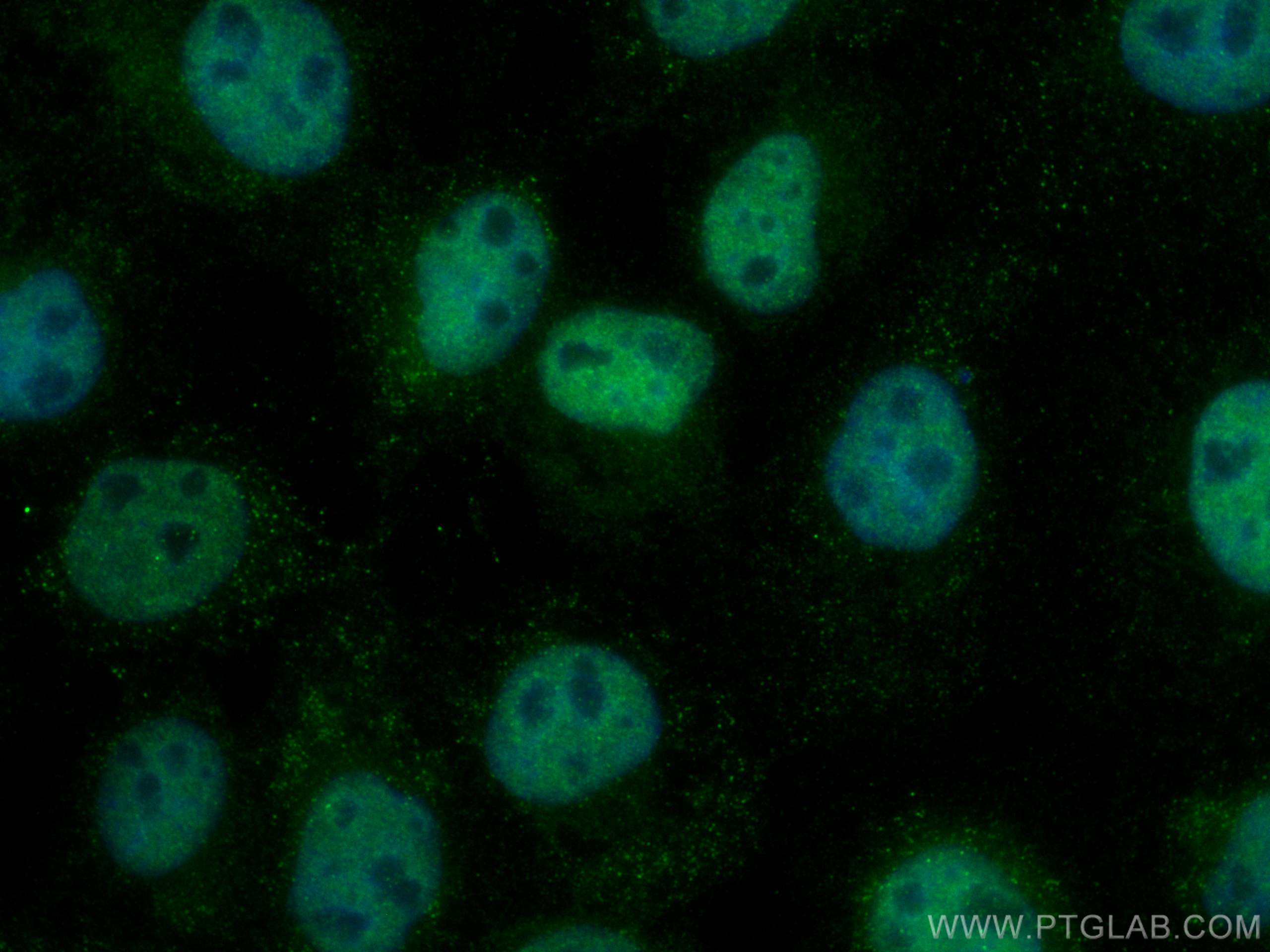 Immunofluorescence (IF) / fluorescent staining of A431 cells using DHRS1 Polyclonal antibody (16275-1-AP)