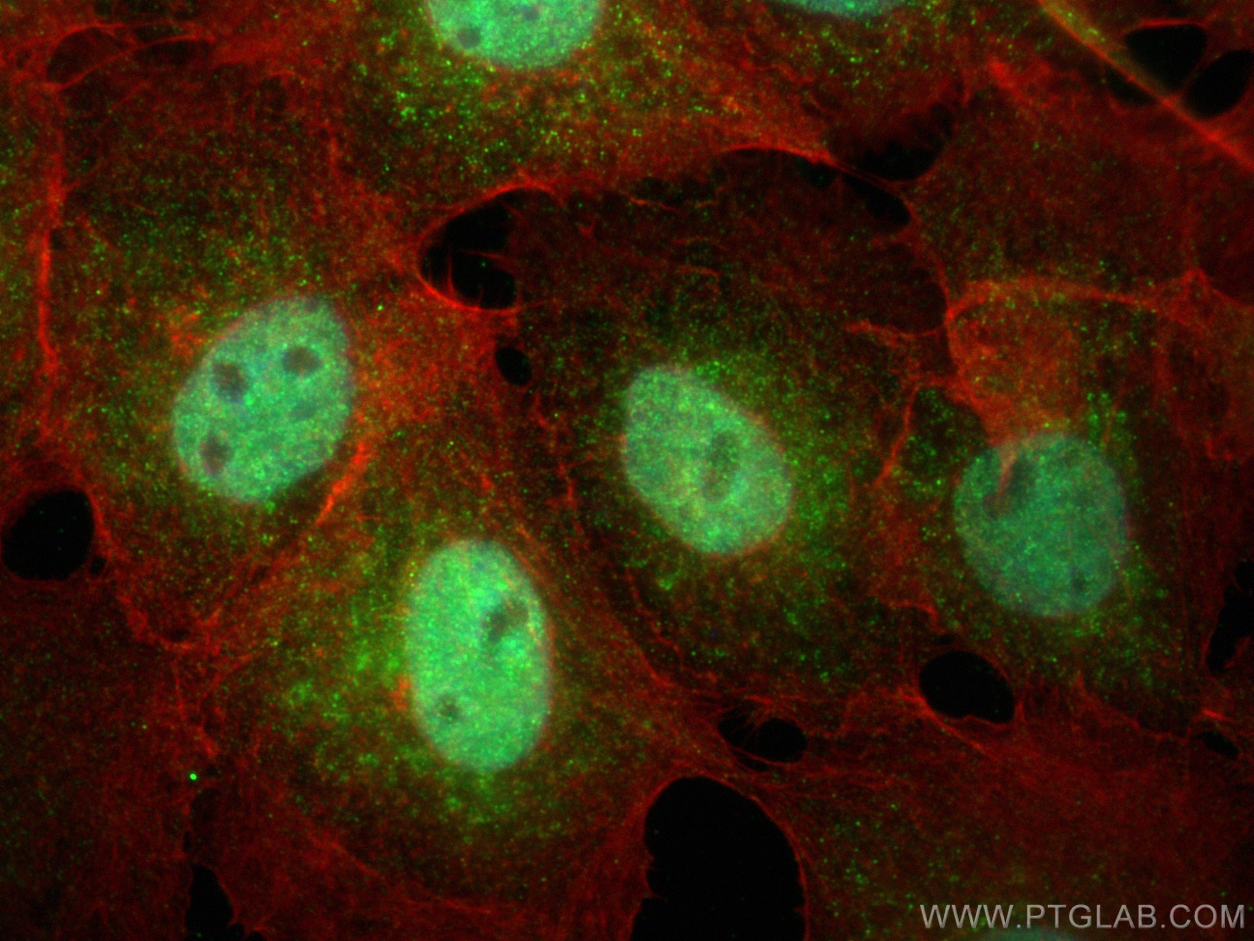 Immunofluorescence (IF) / fluorescent staining of A431 cells using DHRS1 Polyclonal antibody (16275-1-AP)