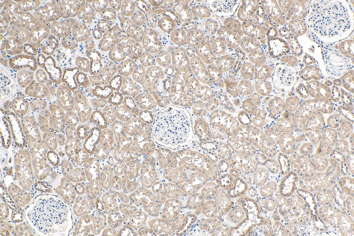 Immunohistochemistry (IHC) staining of human kidney tissue using DHRS1 Polyclonal antibody (16275-1-AP)