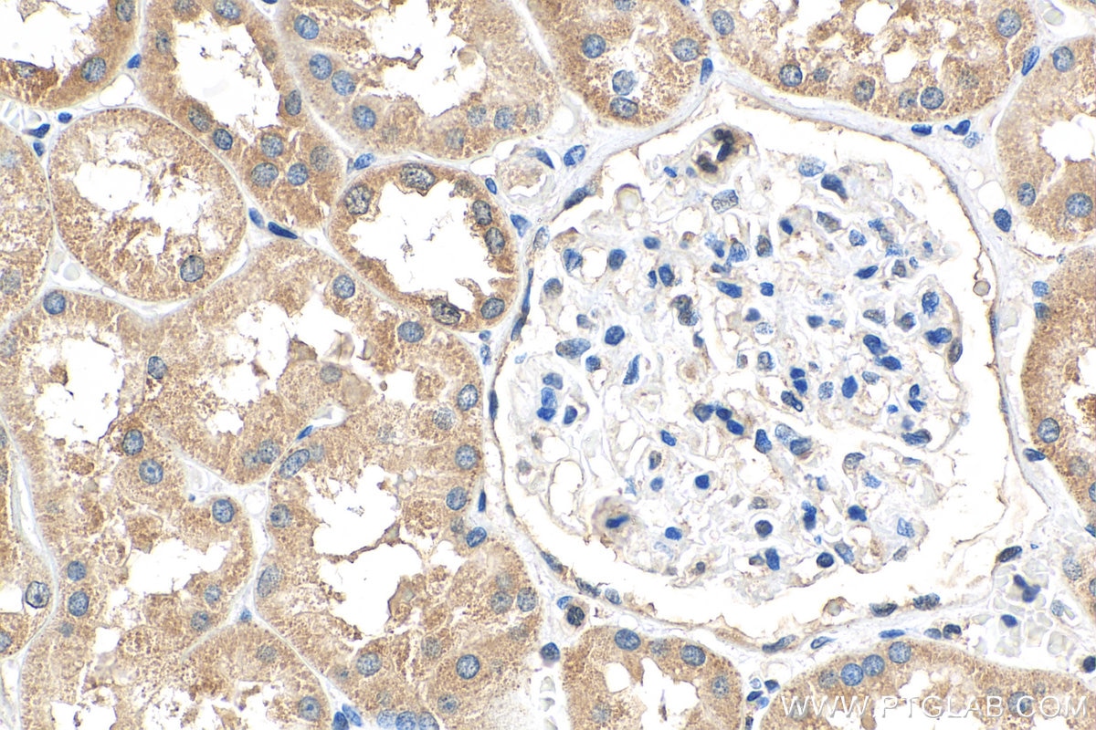 Immunohistochemistry (IHC) staining of human kidney tissue using DHRS1 Polyclonal antibody (16275-1-AP)