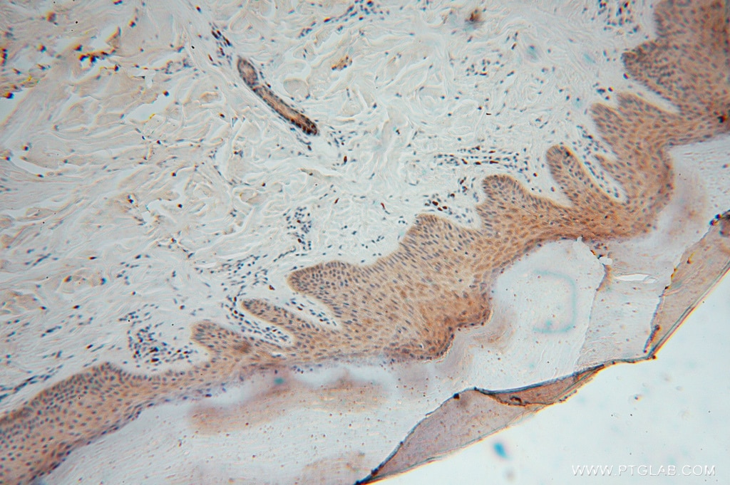 IHC staining of human skin using 16275-1-AP