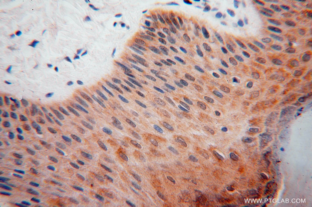 Immunohistochemistry (IHC) staining of human skin tissue using DHRS1 Polyclonal antibody (16275-1-AP)