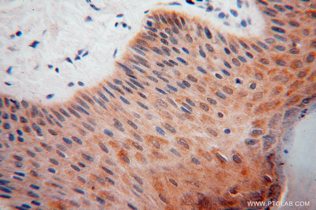 IHC staining of human skin using 16275-1-AP