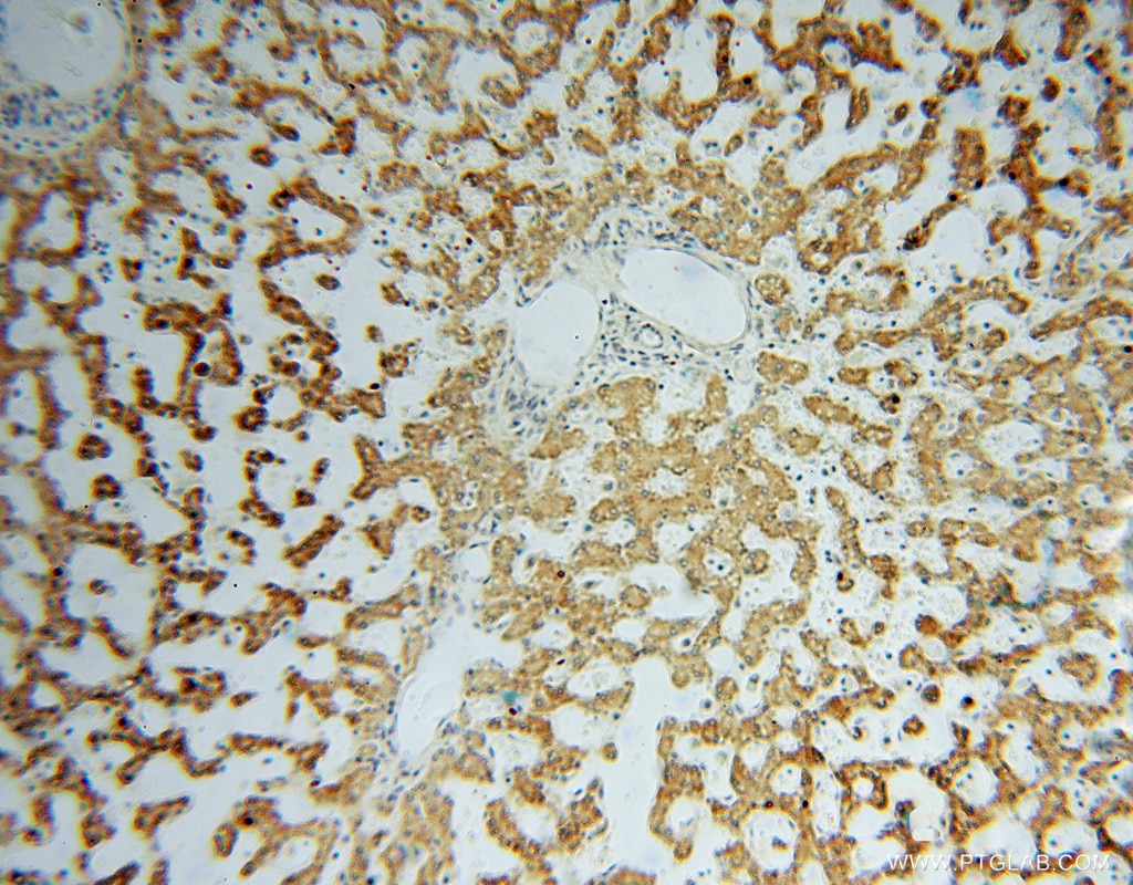 Immunohistochemistry (IHC) staining of human liver tissue using DHRS1 Polyclonal antibody (16275-1-AP)