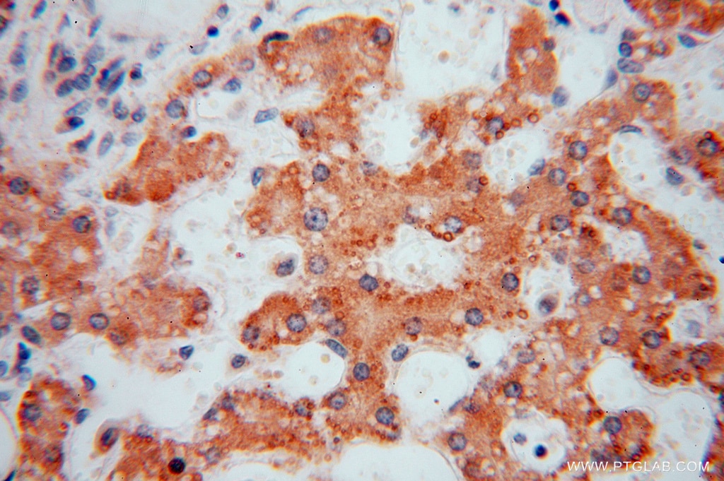 Immunohistochemistry (IHC) staining of human liver tissue using DHRS1 Polyclonal antibody (16275-1-AP)