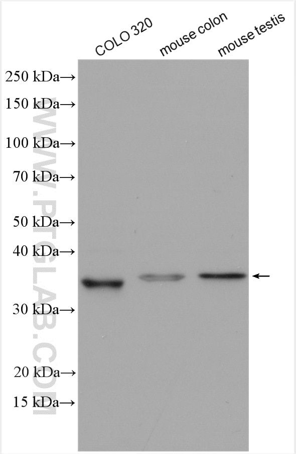 Western Blot (WB) analysis of various lysates using DHRS1 Polyclonal antibody (16275-1-AP)