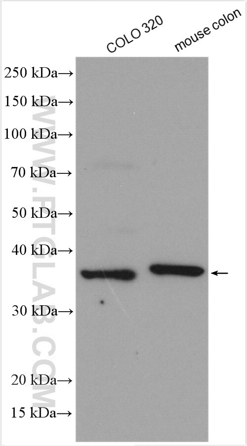 Western Blot (WB) analysis of various lysates using DHRS1 Polyclonal antibody (16275-1-AP)