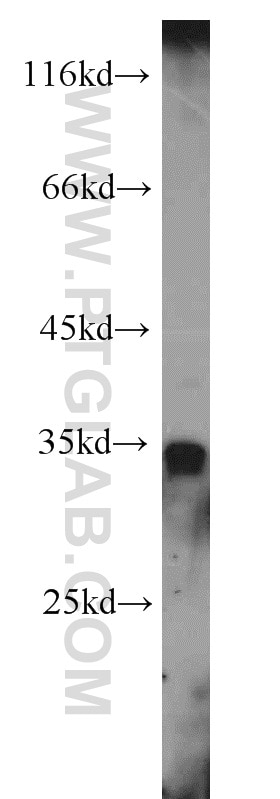 Western Blot (WB) analysis of human liver tissue using DHRS1 Polyclonal antibody (16275-1-AP)