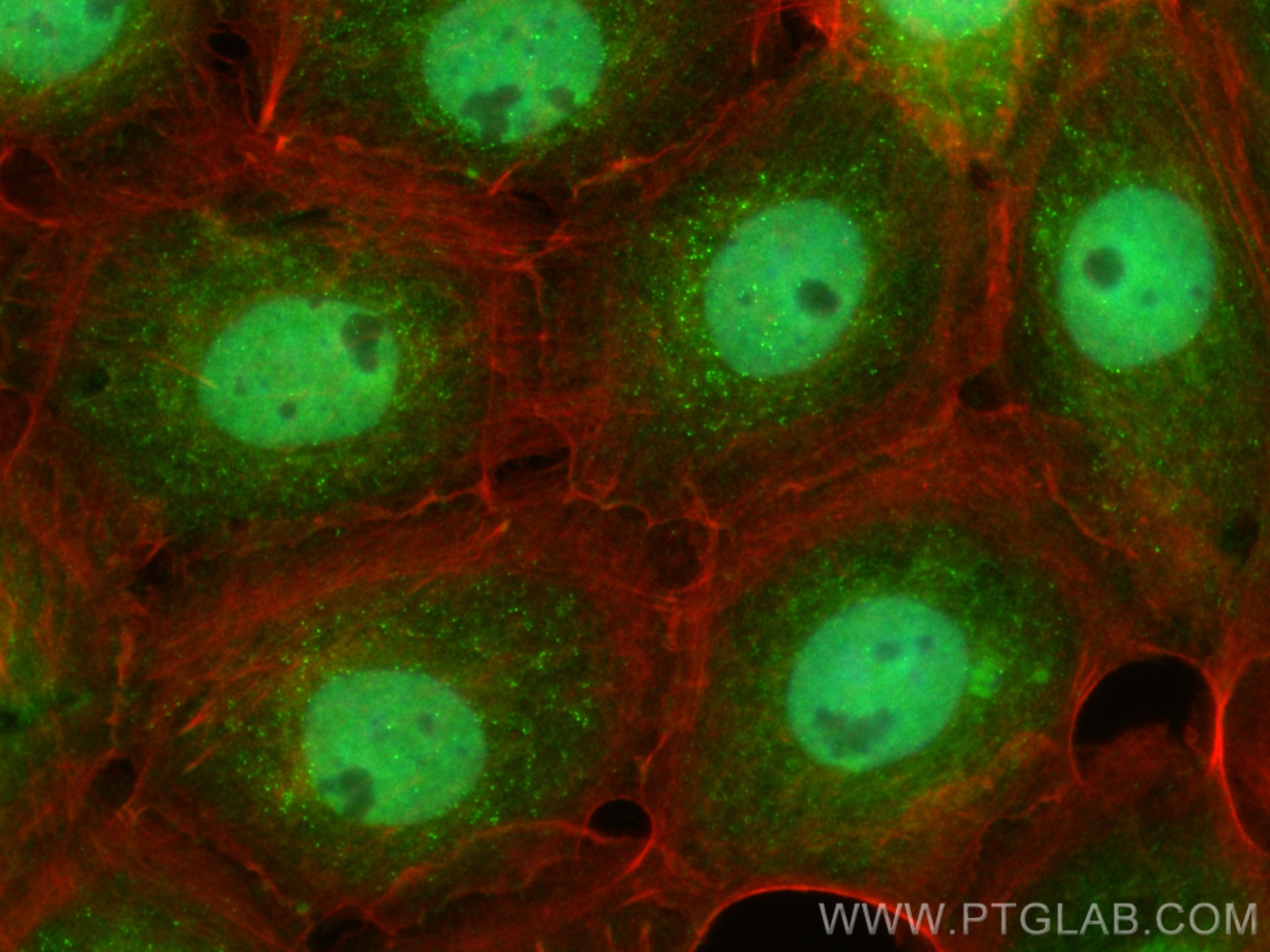 Immunofluorescence (IF) / fluorescent staining of A431 cells using CoraLite® Plus 488-conjugated DHRS1 Polyclonal ant (CL488-16275)
