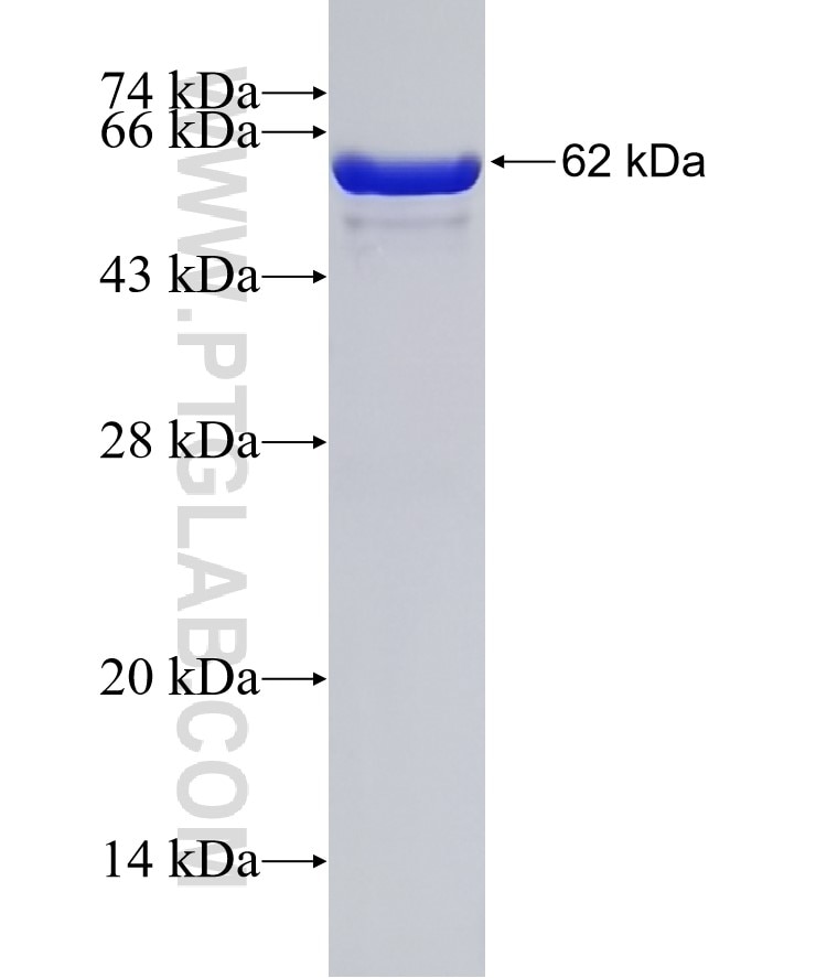 DHRS1 fusion protein Ag9351 SDS-PAGE