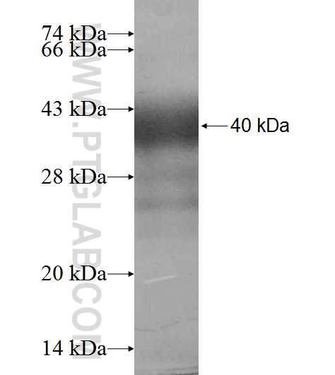 DHRS1 fusion protein Ag9628 SDS-PAGE