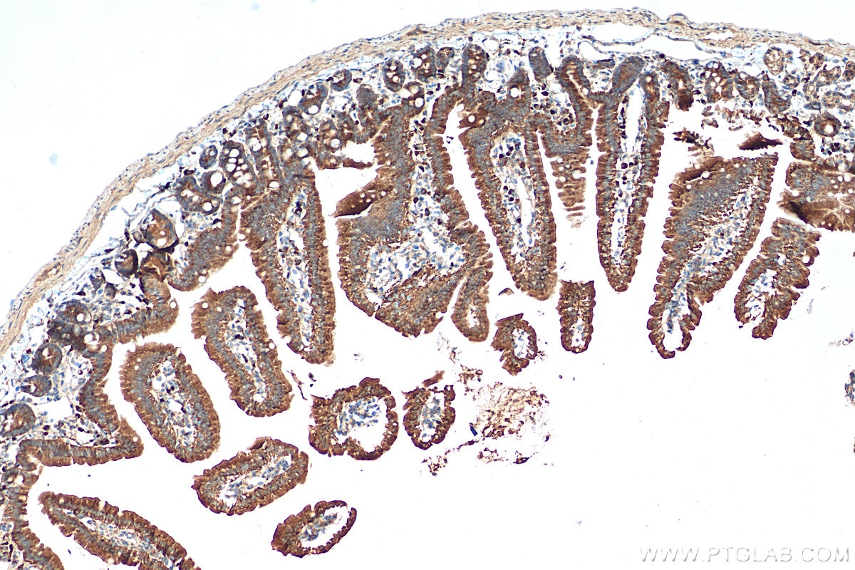 Immunohistochemistry (IHC) staining of mouse small intestine tissue using DHRS11 Polyclonal antibody (20172-1-AP)