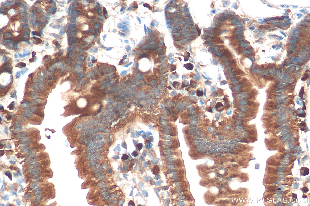 Immunohistochemistry (IHC) staining of mouse small intestine tissue using DHRS11 Polyclonal antibody (20172-1-AP)