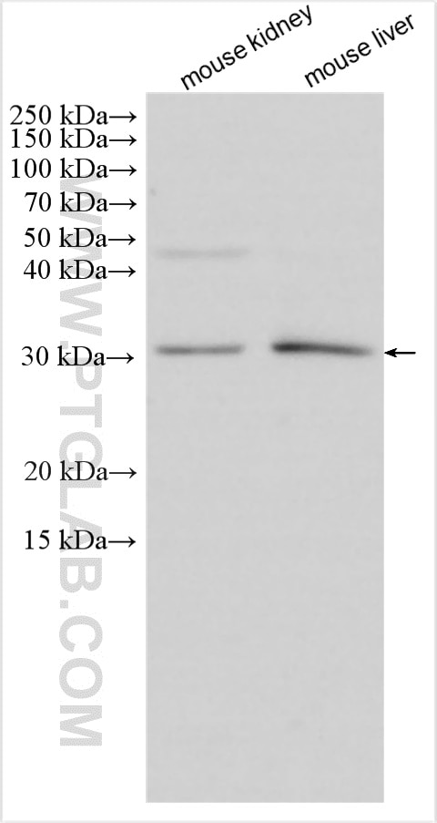 Western Blot (WB) analysis of various lysates using DHRS11 Polyclonal antibody (20172-1-AP)
