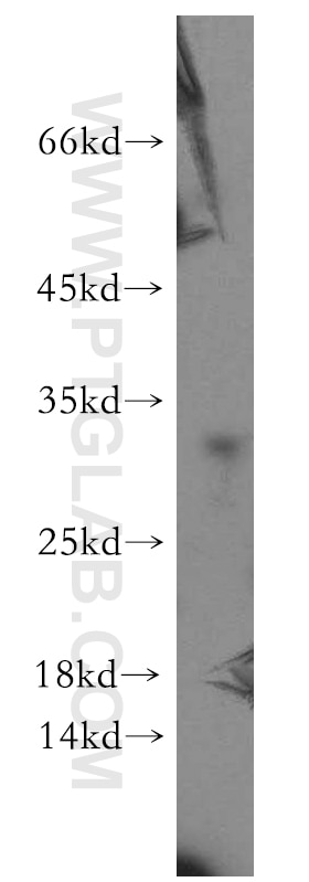 Western Blot (WB) analysis of COLO 320 cells using DHRS11 Polyclonal antibody (20172-1-AP)