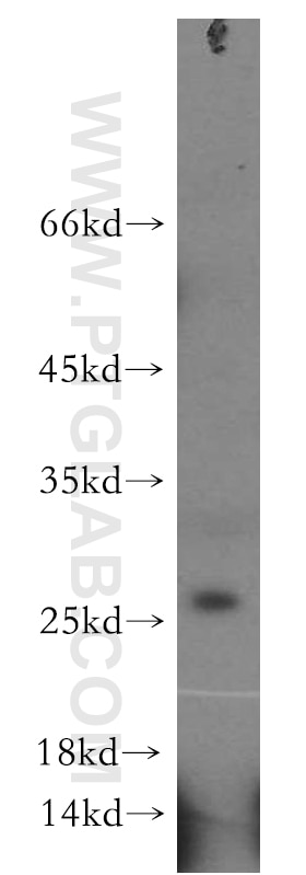 Western Blot (WB) analysis of mouse liver tissue using DHRS11 Polyclonal antibody (20172-1-AP)