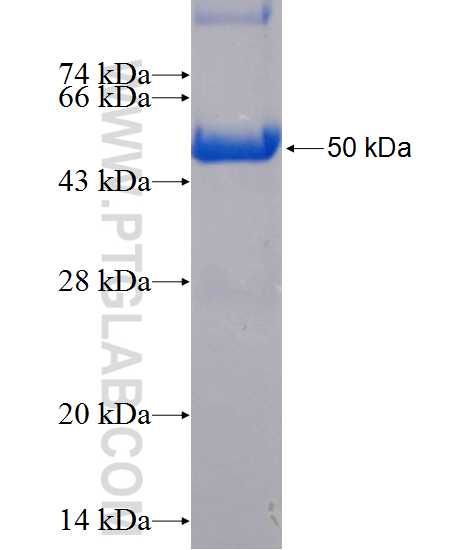 DHRS11 fusion protein Ag14005 SDS-PAGE
