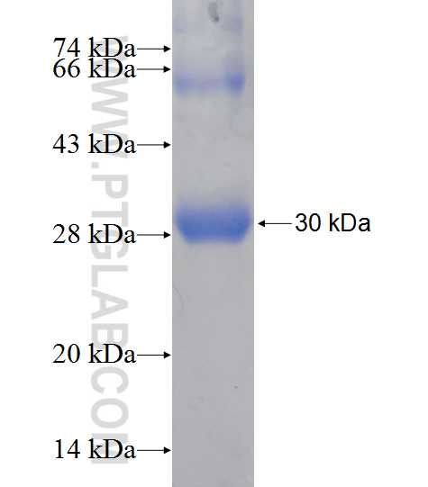 DHRS11 fusion protein Ag14050 SDS-PAGE