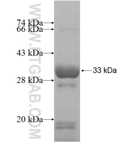 DHRS12 fusion protein Ag9102 SDS-PAGE