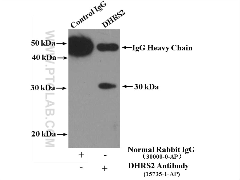 IP experiment of HeLa using 15735-1-AP