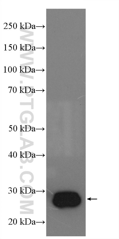 Western Blot (WB) analysis of SKOV-3 cells using DHRS2 Polyclonal antibody (15735-1-AP)