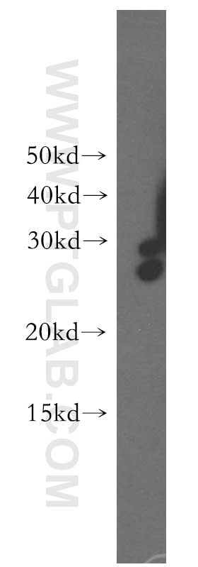 Western Blot (WB) analysis of human liver tissue using DHRS2 Polyclonal antibody (15735-1-AP)