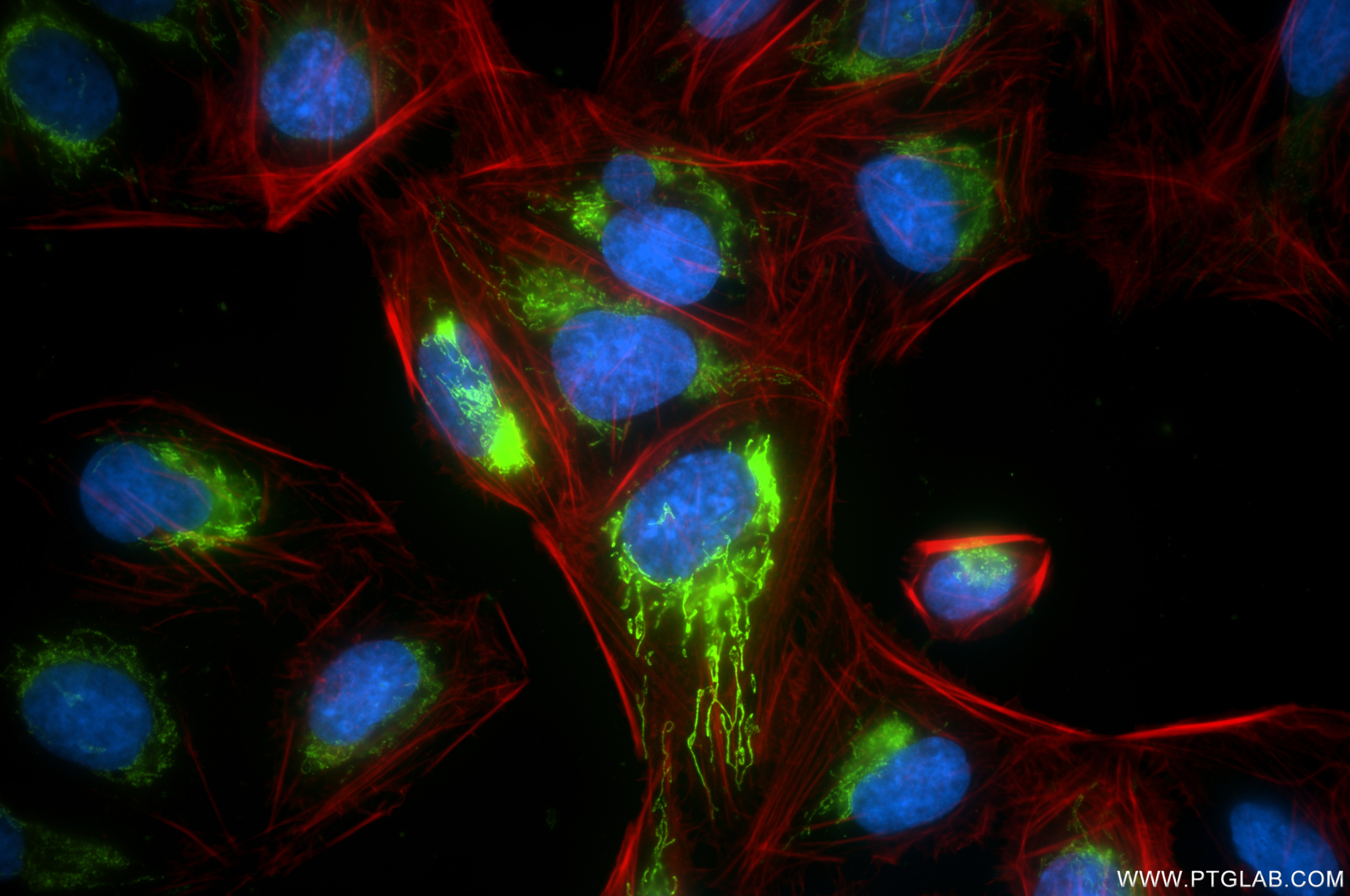 Immunofluorescence (IF) / fluorescent staining of U2OS cells using DHRS2 Recombinant antibody (86309-2-RR)