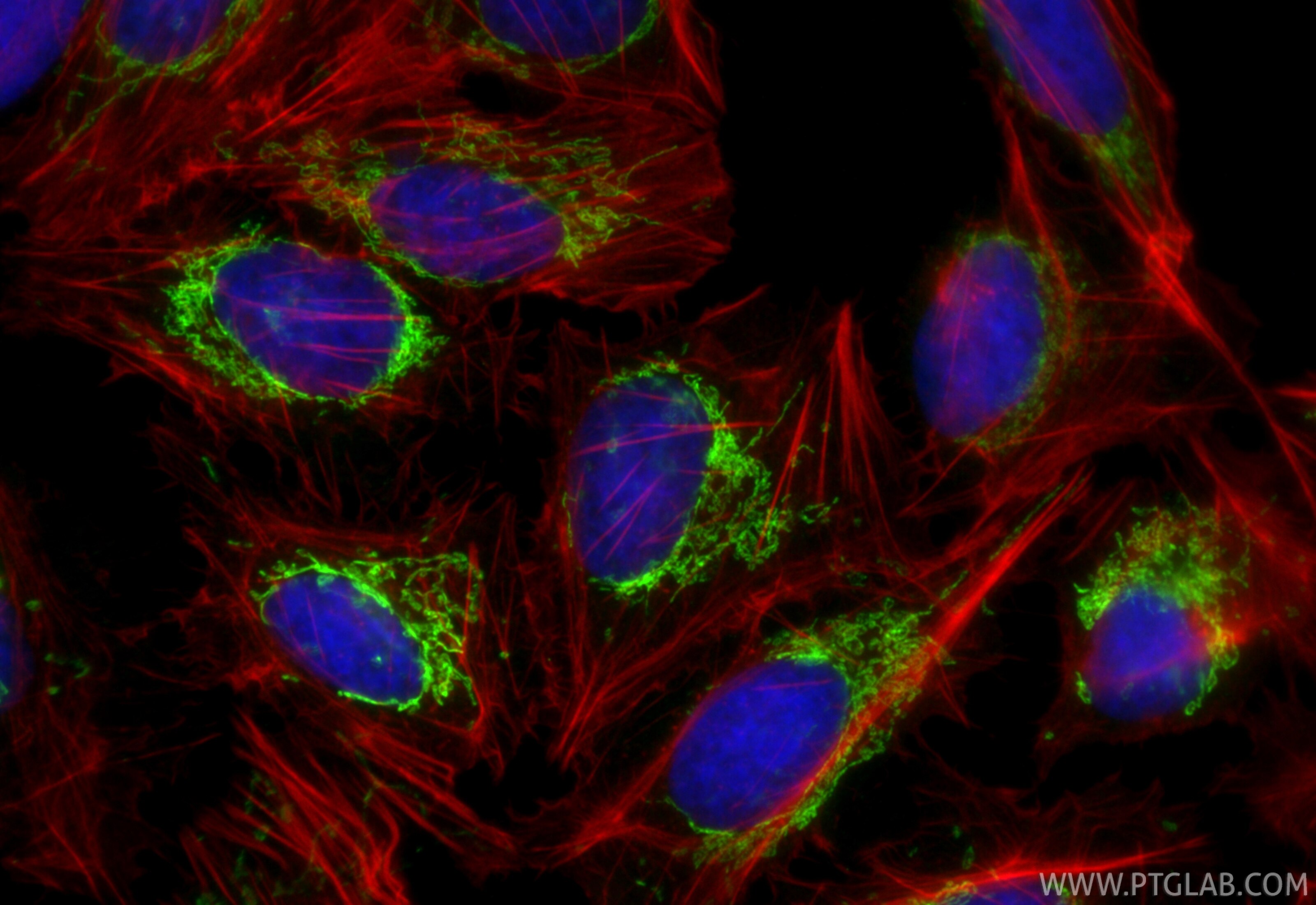 Immunofluorescence (IF) / fluorescent staining of U2OS cells using CoraLite® Plus 488-conjugated DHRS2 Recombinant mo (CL488-86309-2)