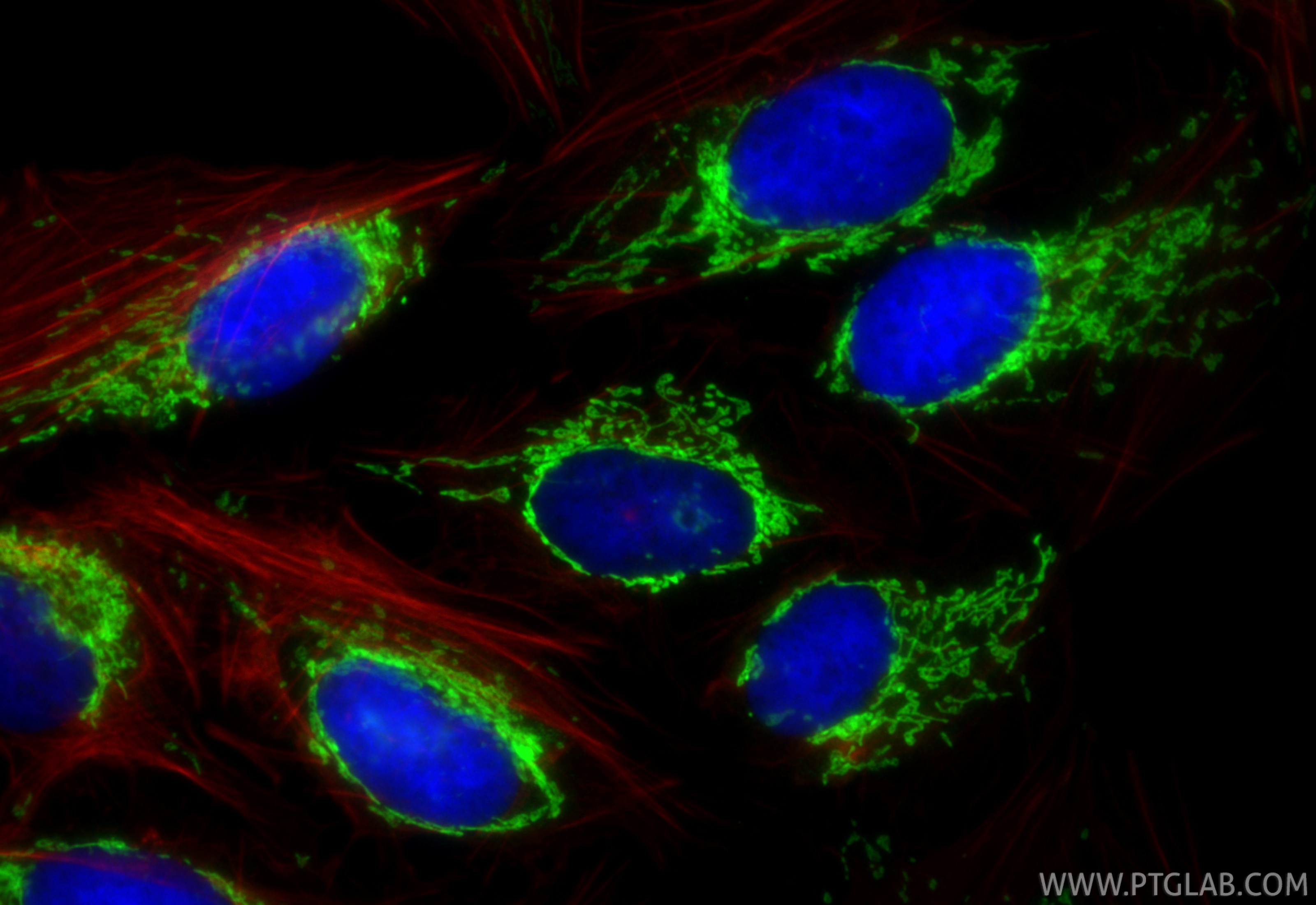 IF Staining of U2OS using RMX00088 Immunofluorescence (IF) / fluorescent staining of U2OS cells using Multi-rAb® DHRS2 Multi-Recombinant antibody (RMX00088)