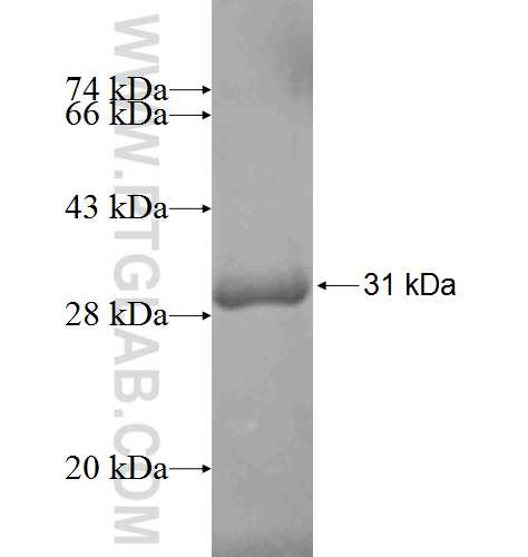 DHRS2 fusion protein Ag8364 SDS-PAGE