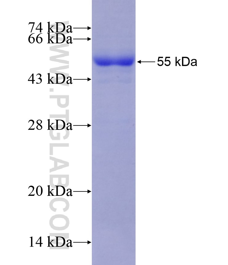 DHRS2 fusion protein Ag8508 SDS-PAGE