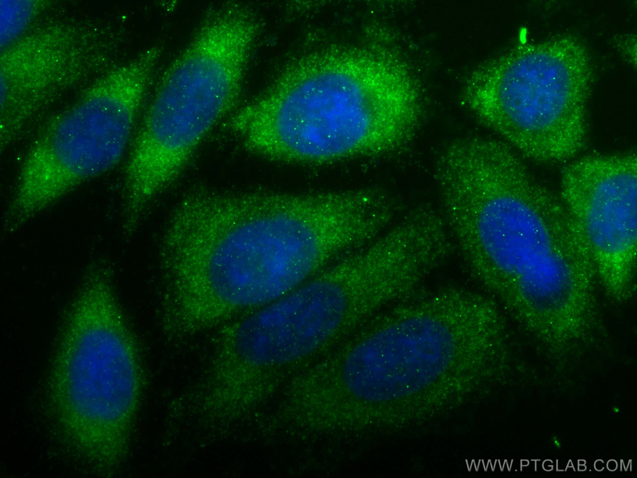 Immunofluorescence (IF) / fluorescent staining of HepG2 cells using DHRS3 Polyclonal antibody (15393-1-AP)