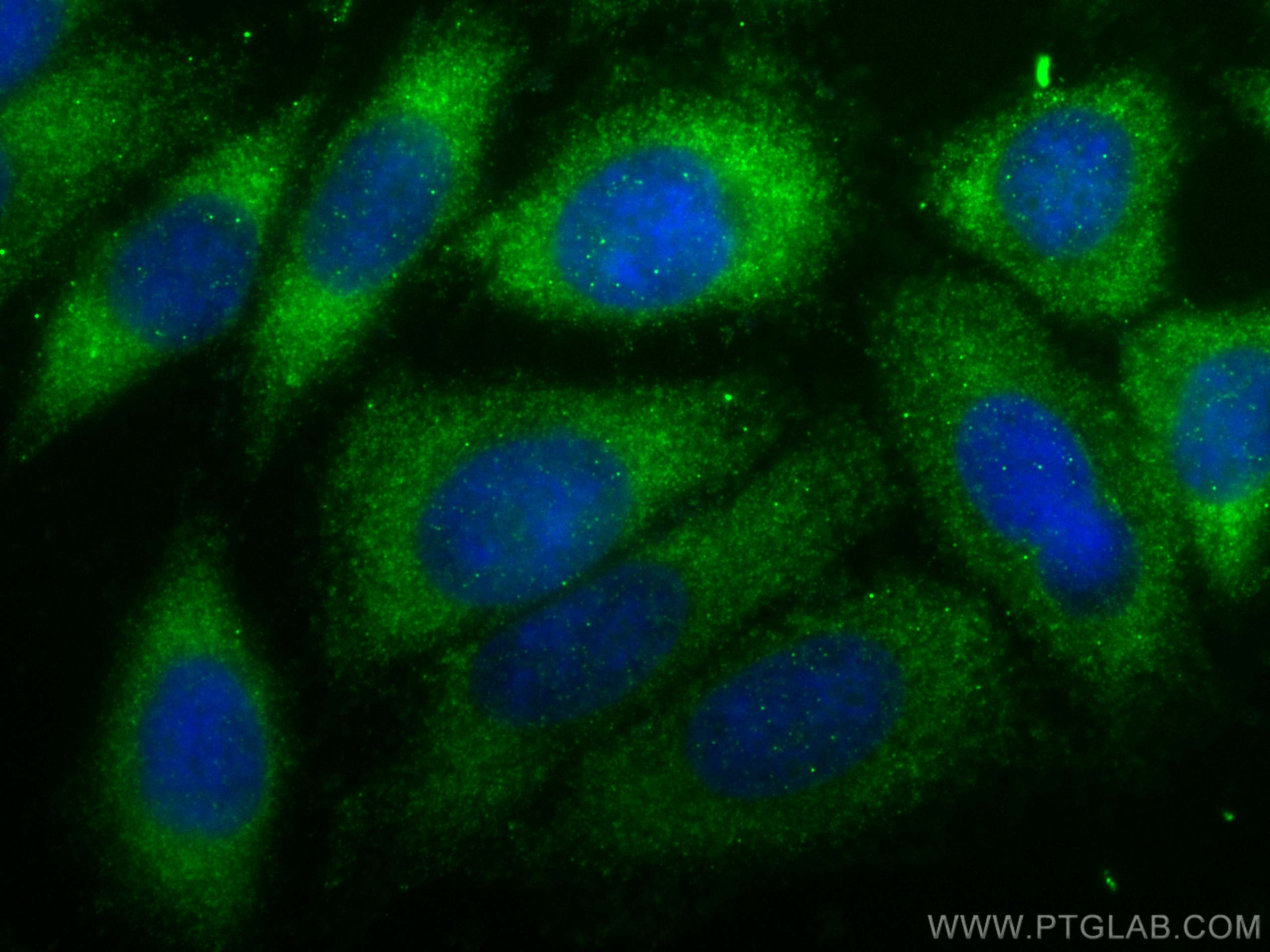 Immunofluorescence (IF) / fluorescent staining of HepG2 cells using DHRS3 Polyclonal antibody (15393-1-AP)