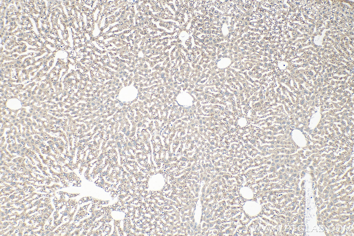 Immunohistochemistry (IHC) staining of mouse liver tissue using DHRS3 Polyclonal antibody (15393-1-AP)