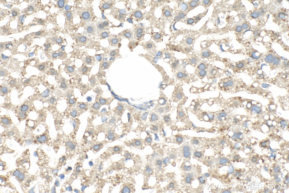 Immunohistochemistry (IHC) staining of mouse liver tissue using DHRS3 Polyclonal antibody (15393-1-AP)