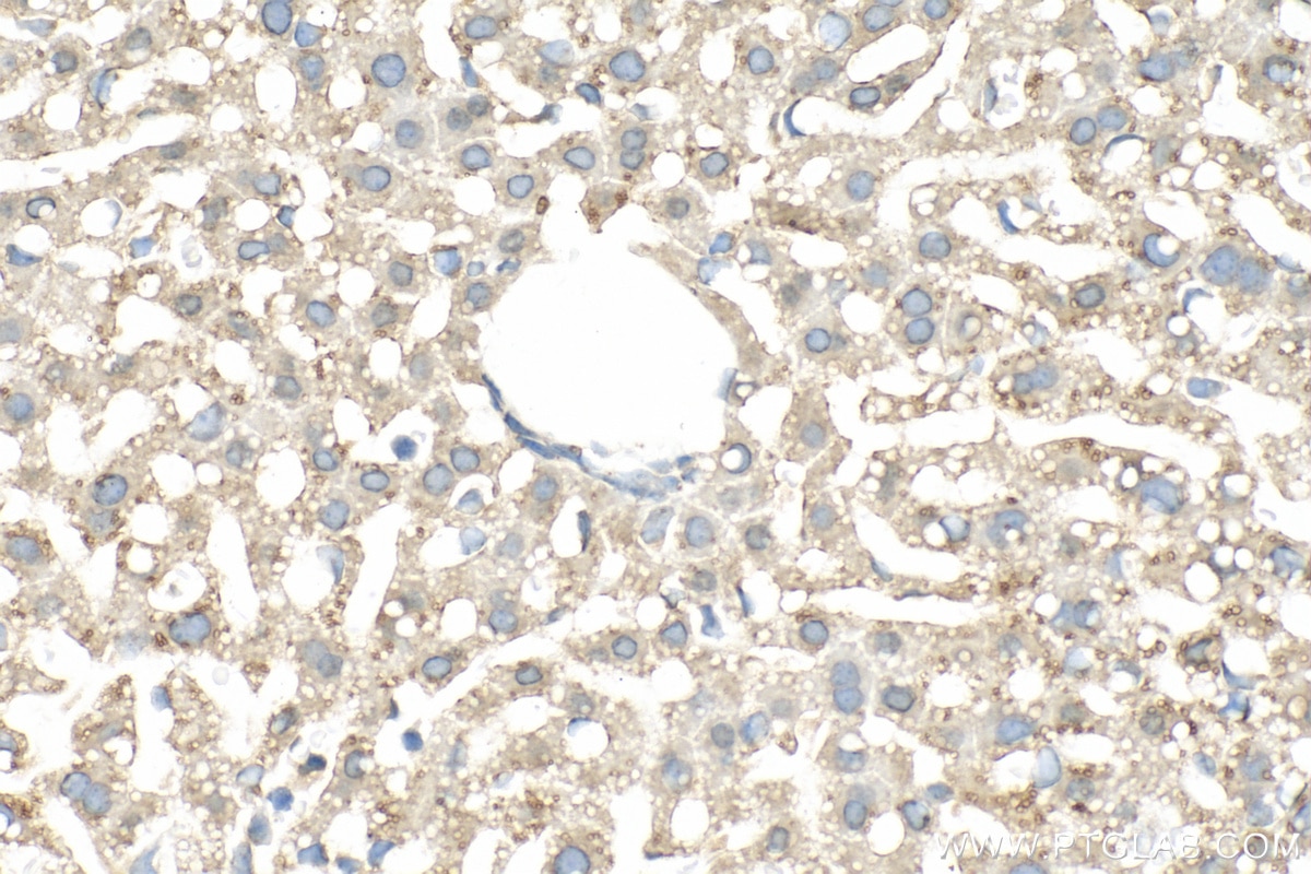 IHC staining of mouse liver using 15393-1-AP