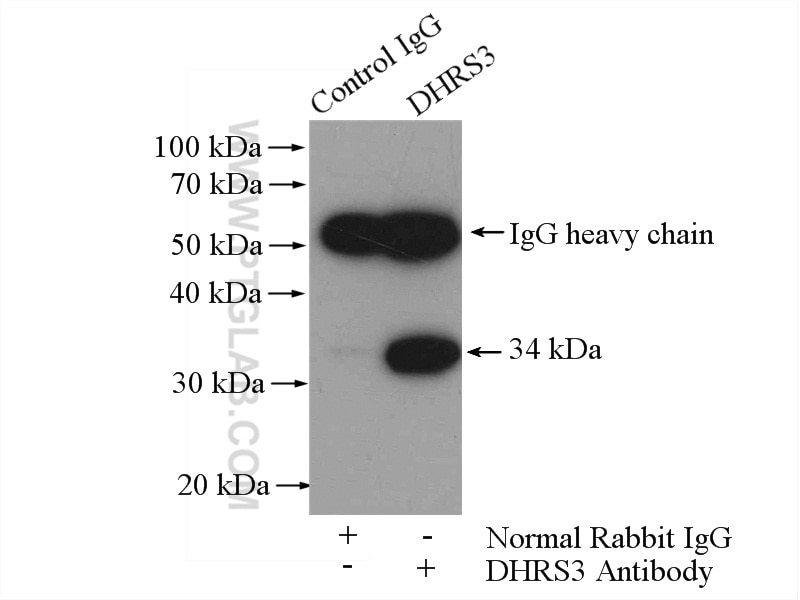 Immunoprecipitation (IP) experiment of A375 cells using DHRS3 Polyclonal antibody (15393-1-AP)