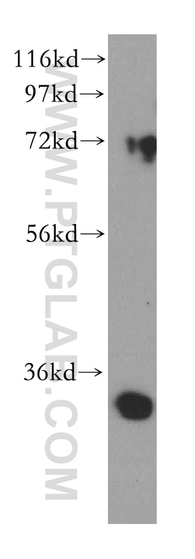 Western Blot (WB) analysis of A375 cells using DHRS3 Polyclonal antibody (15393-1-AP)