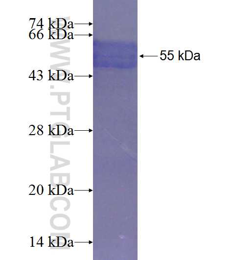 DHRS3 fusion protein Ag7589 SDS-PAGE