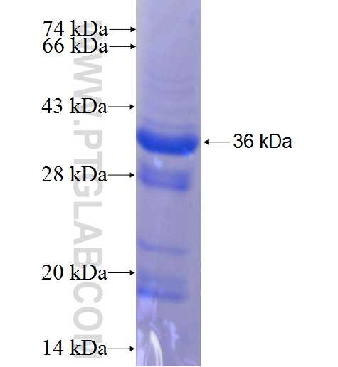 DHRS3 fusion protein Ag7961 SDS-PAGE