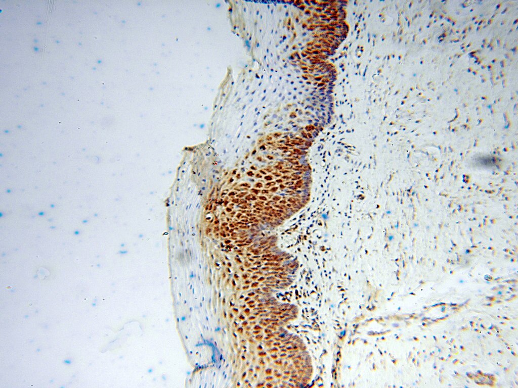 Immunohistochemistry (IHC) staining of human cervix tissue using DHRS4 Polyclonal antibody (15279-1-AP)