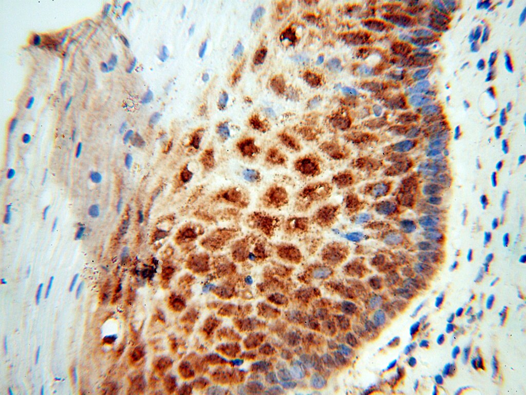 Immunohistochemistry (IHC) staining of human cervix tissue using DHRS4 Polyclonal antibody (15279-1-AP)